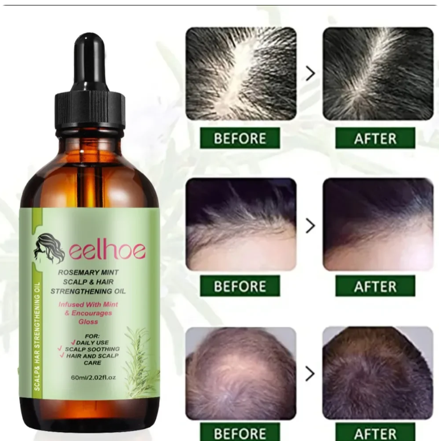 Hair Growth Rosemary Oil